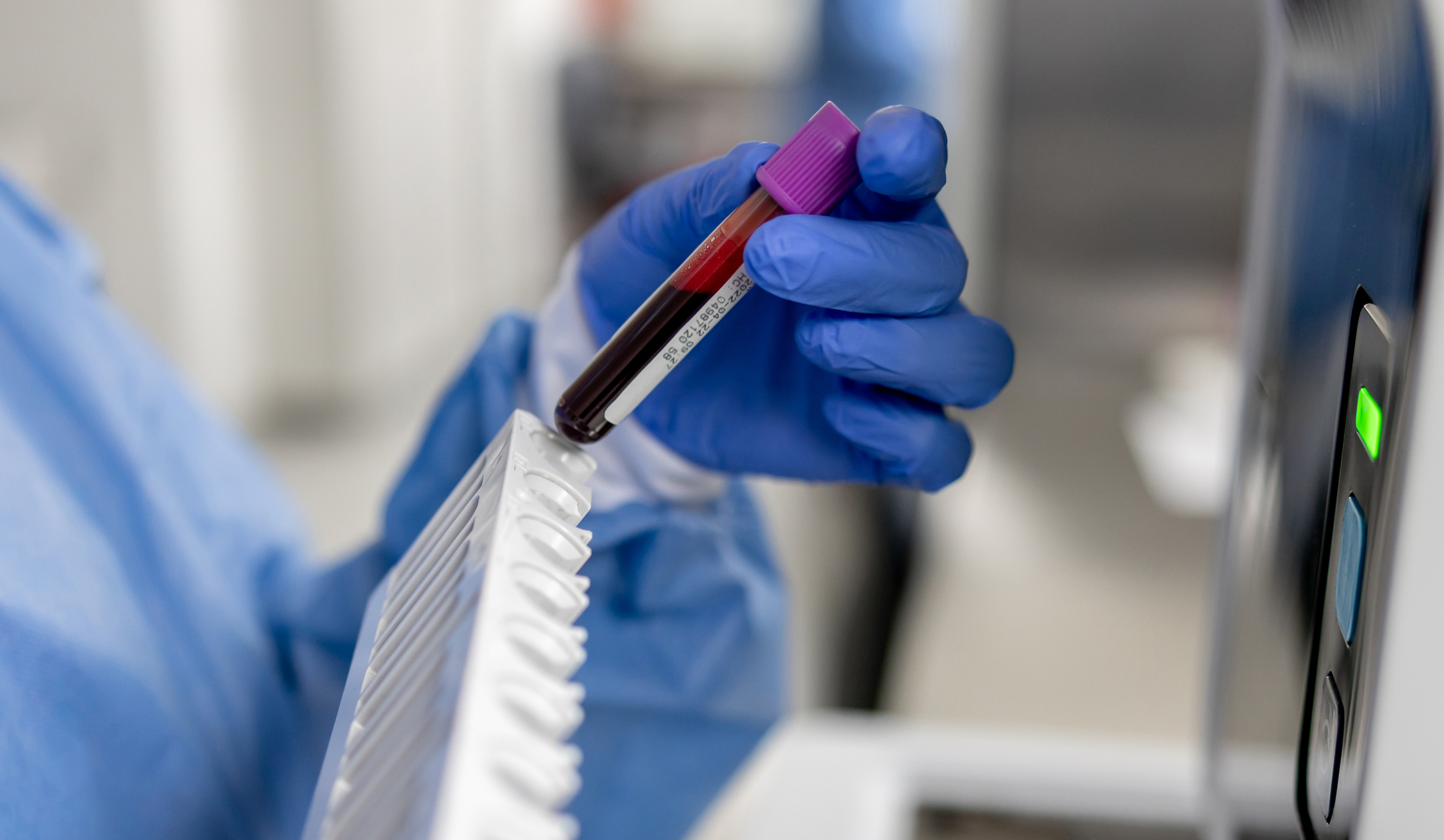 Close-up on a technician analyzing blood samples at the lab